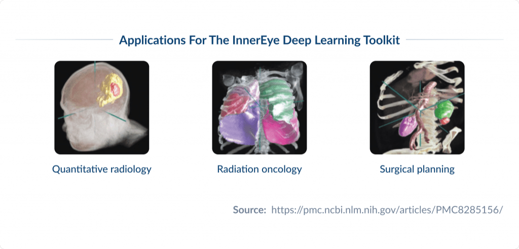 Applications for the Innereye Deep Learning Toolkit